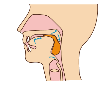 図3：咽頭期の様子を示す図。食塊を咽頭から食道入り口へ送り込んでいるところを示す。