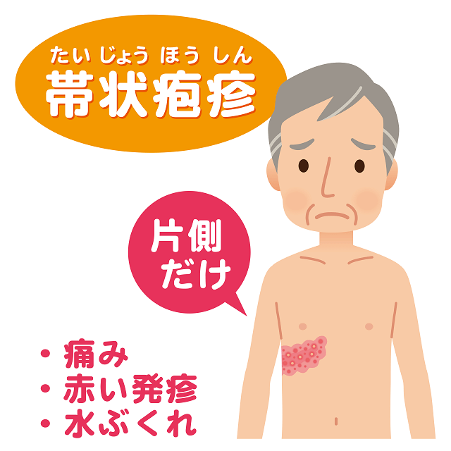 図：帯状疱疹の症状「痛み」「赤い発疹」「水ぶくれ」を表すイメージ。