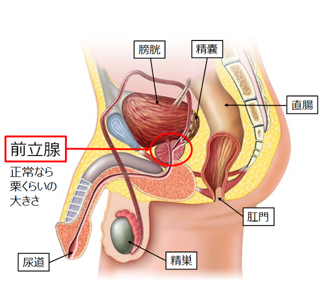 図：前立腺とその周辺の臓器や器官を示す図。前立腺の周辺には膀胱、精嚢、精巣、尿道がある。前立腺は正常なら栗くらいの大きさである。