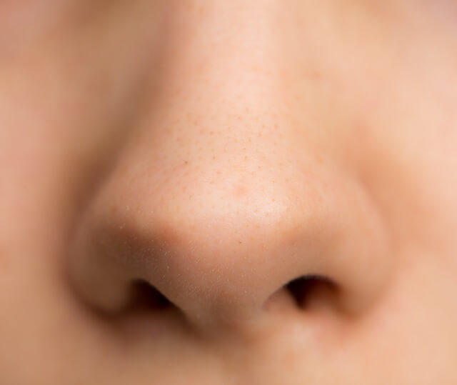 写真３：鼻の写真