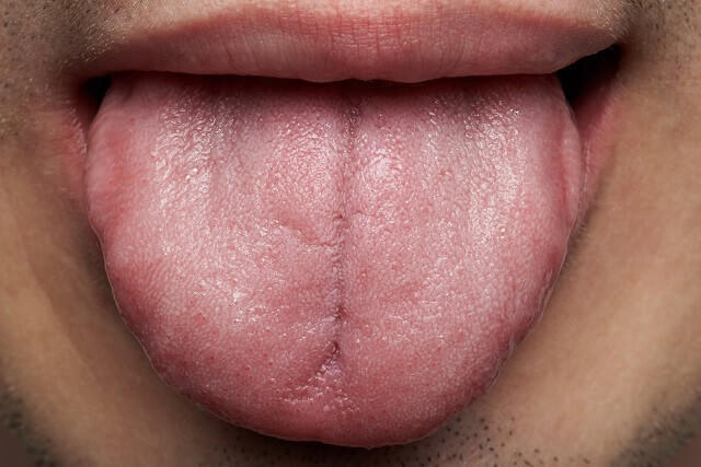写真４：舌の写真