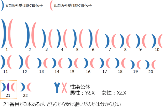 図1:ダウン症候群の人の染色体(21トリソミー)を示す図。21番目の常染色体が3本存在し、合計47本の染色体をもっていることを表す。