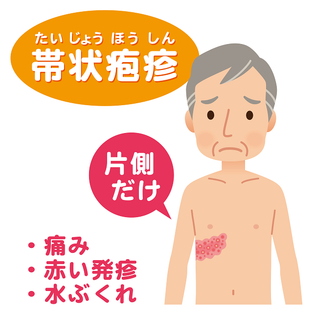 図:帯状疱疹の症状「痛み」「赤い発疹」「水ぶくれ」を表すイメージ。