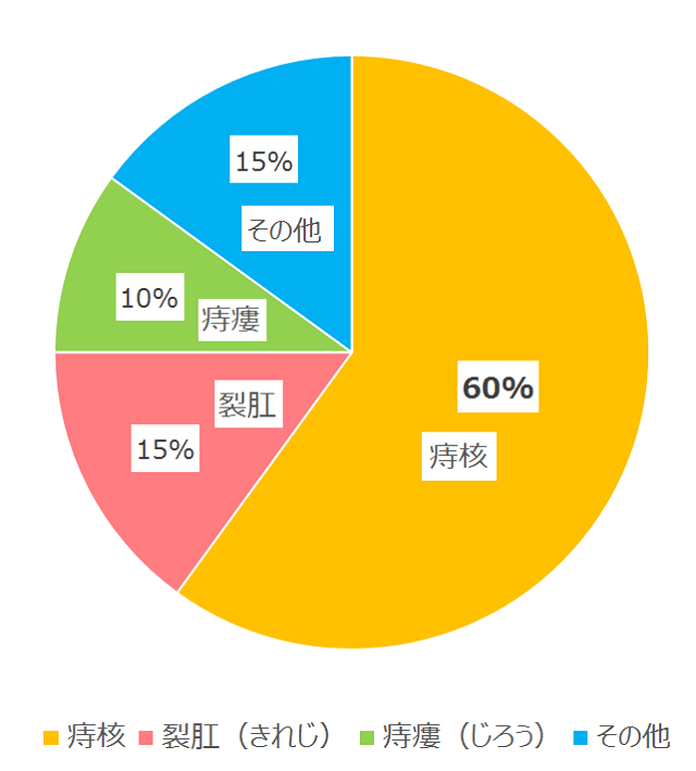 図1:肛門疾患に占める「痔」の割合を示す円グラフ。60%が痔核を締めることを示す。