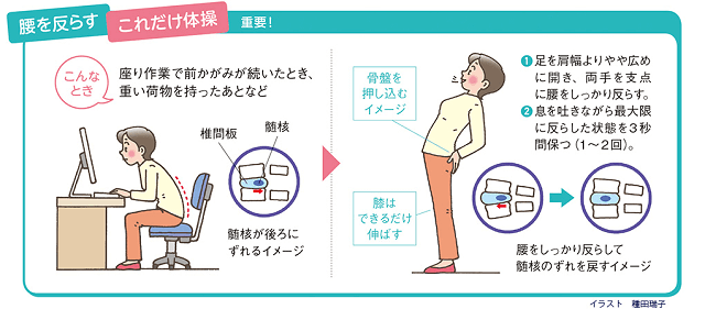 図1:腰をそらす「これだけ体操」。立位で腰を両手を支点にそらし、息を吐き3秒間保つ