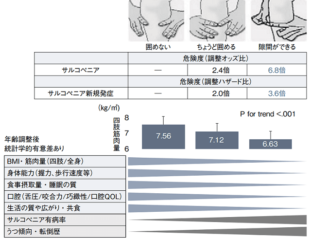 図2:「指輪っかテスト」によるフレイルの簡易スクリーニングを示す図。両手の人差し指と親指で自身の下腿周囲の最大部分を囲ってみて「囲めない」「ちょうど囲める」「隙間ができる」でサルコペニア評価する。隙間ができるの場合サルコペニアの危険度が高い。