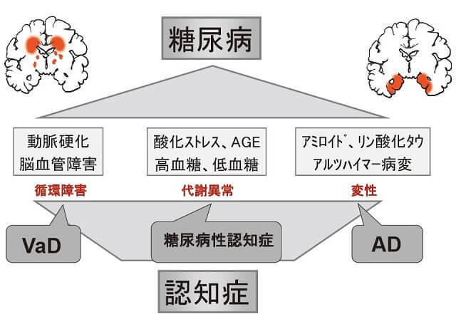 図１：インスリン障害によるAD病理過程の促進と循環障害や代謝異常が加わり認知症の発症を早めていることをあらわす図