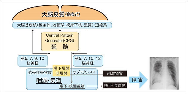 図1：上気道防御反射と誤嚥性肺炎発症メカニズムの関連を示す図。