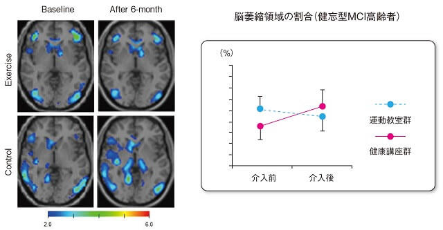 図3:脳萎縮の改善を示すMRI画像および運動教室群、健康講座群別の脳萎縮領域の割合を示すグラフ。