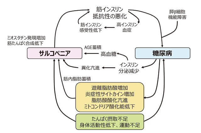 図1：糖尿病とサルコペニアの関係を表す図。