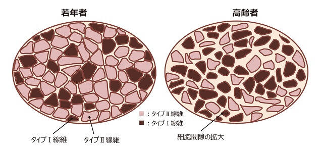 図3：骨格筋の加齢変化について若年者と高齢者との比較を示す図。