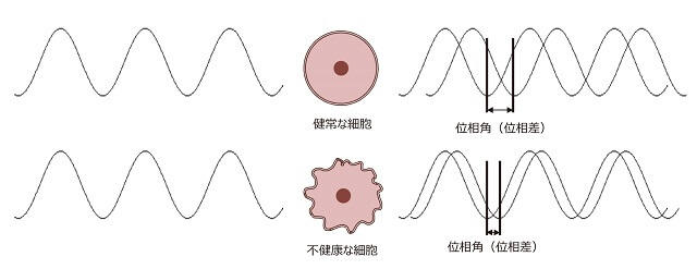 図8：骨格筋の質を位相角で測定した際のイメージ図。