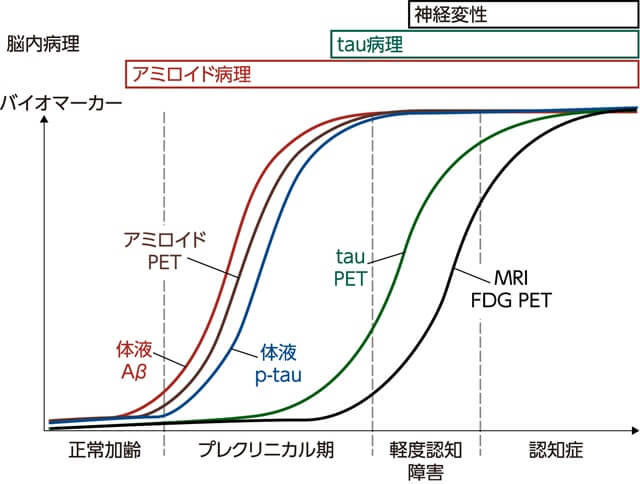 図、アルツハイマー病の経過とバイオマーカーを表す図。