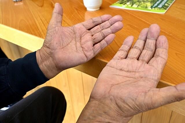 のぐちさんの手の写真。