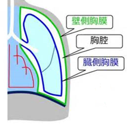 図1：胸膜を示す図。胸膜は肺の組織を覆っている。胸膜まで炎症が広がると胸が強く痛む