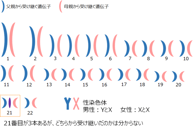 図1：ダウン症候群の人の染色体（21トリソミー）を示す図。21番目の常染色体が3本存在し、合計47本の染色体をもっていることを表す。