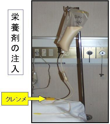 経管栄養法の手順 健康長寿ネット