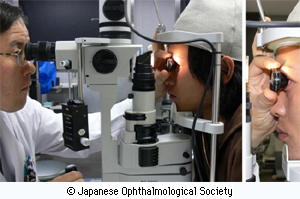 写真3：専門の特殊なコンタクトレンズを患者さんの目に押し当てて、隅角が目詰まりしていないかを確認するしている隅角検査の風景写真