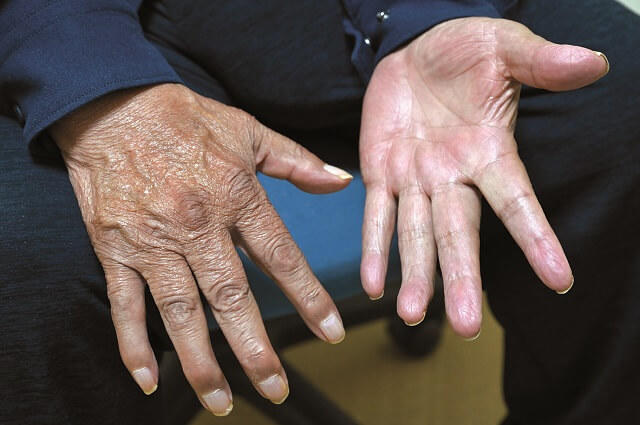 写真：三浦氏の骨太でがっちりした手を表す写真。