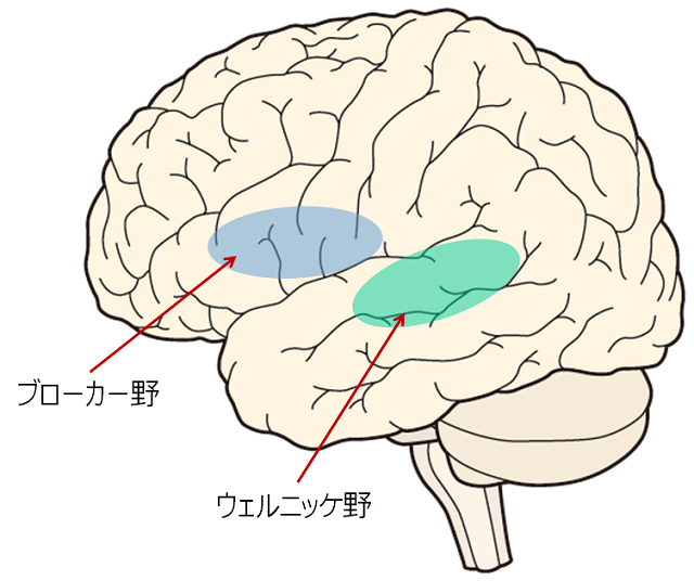 図1：脳の言語中枢のブローカー野とウェルニッケ野をしめす図