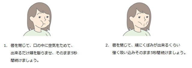 図1：唇を閉じ、頬を膨らませたりすぼめたりする頬の体操を表す図。