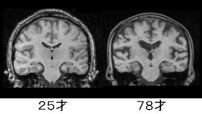 グラフ1：平均寿命と健康寿命の推移を示すグラフ。平均寿命・健康寿命ともに過去10年で男女とも高くなっていることを示す