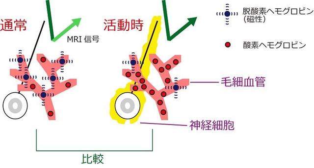 図：通常時と脳活動時のMRI信号の変化の比較