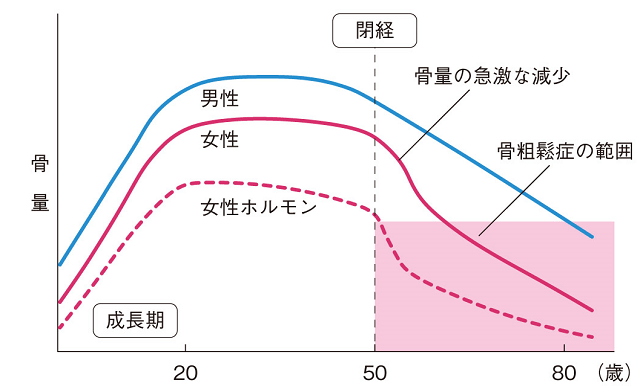 図1：年齢と閉経にともなう骨量の変化を表す図。女性は第二次性徴の後、骨は急激に増加し、一定のレベルに達した後閉経とともに骨の量が低下することを示す。