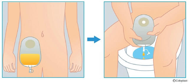 図3：畜尿袋と排泄のイメージを表す図。