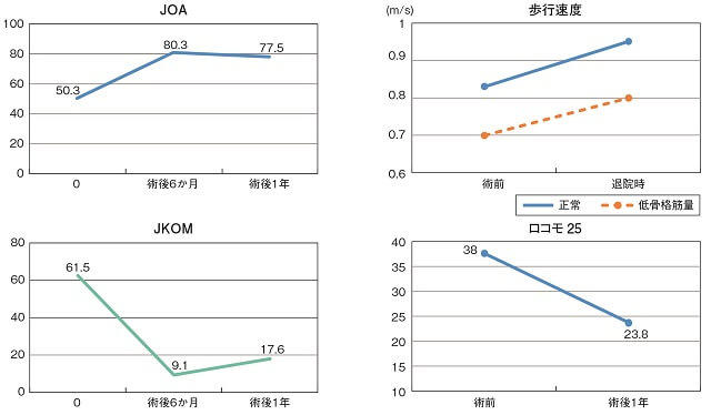 図5：TKA術前、術後でのJOA、歩行速度、JKOM、ロコモ25の成績評価を表すグラフ。