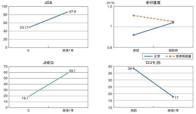 図6：THA術前、術後でのJOA、歩行速度、JHEQ、ロコモ25の成績評価を表すグラフ。