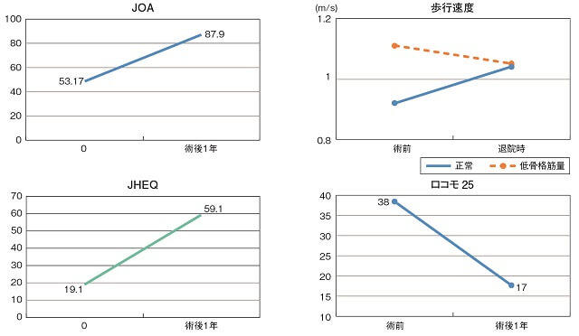 図6:THA術前、術後でのJOA、歩行速度、JHEQ、ロコモ25の成績評価を表すグラフ。