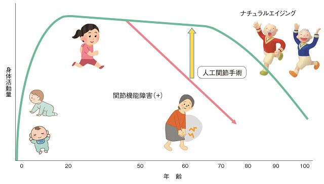 図7:年齢と身体活動の関係と変形性関節症による関節の機能障害により身体活動が低下することに対し、人工関節手術の意義を示す図。