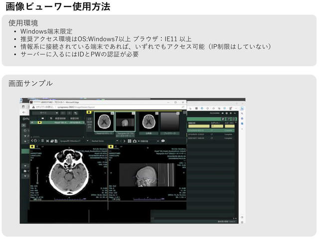 脳画像情報のビューワーの使用方法を説明する画面を表した図